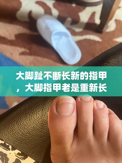 大脚趾不断长新的指甲,大脚指甲老是重新长