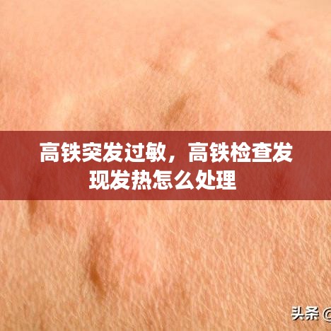 高铁突发过敏，高铁检查发现发热怎么处理 